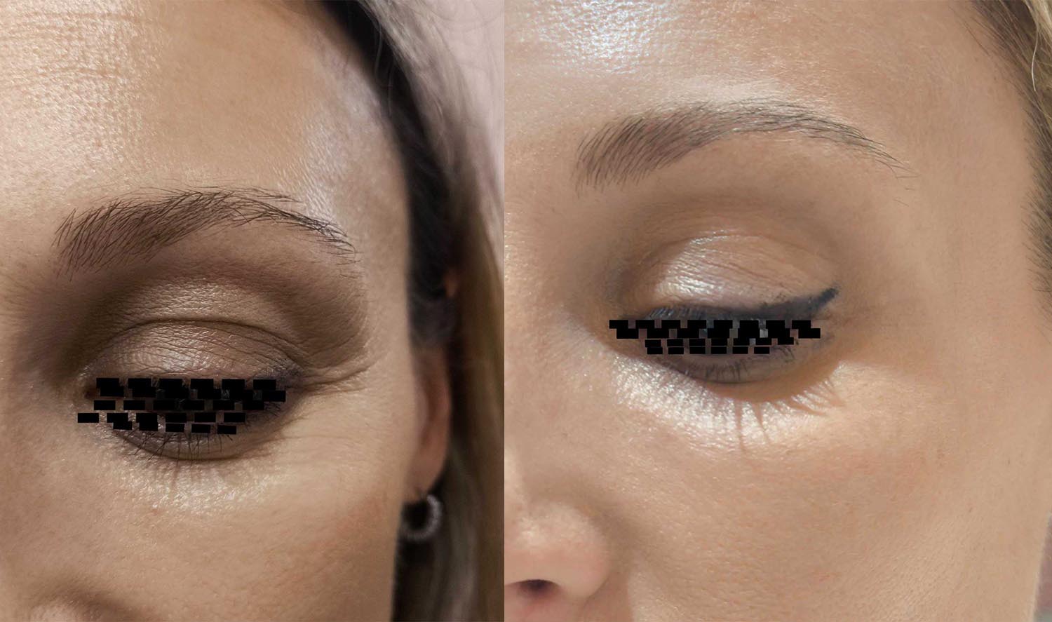 NeoE.V.O.Lift - Image 2