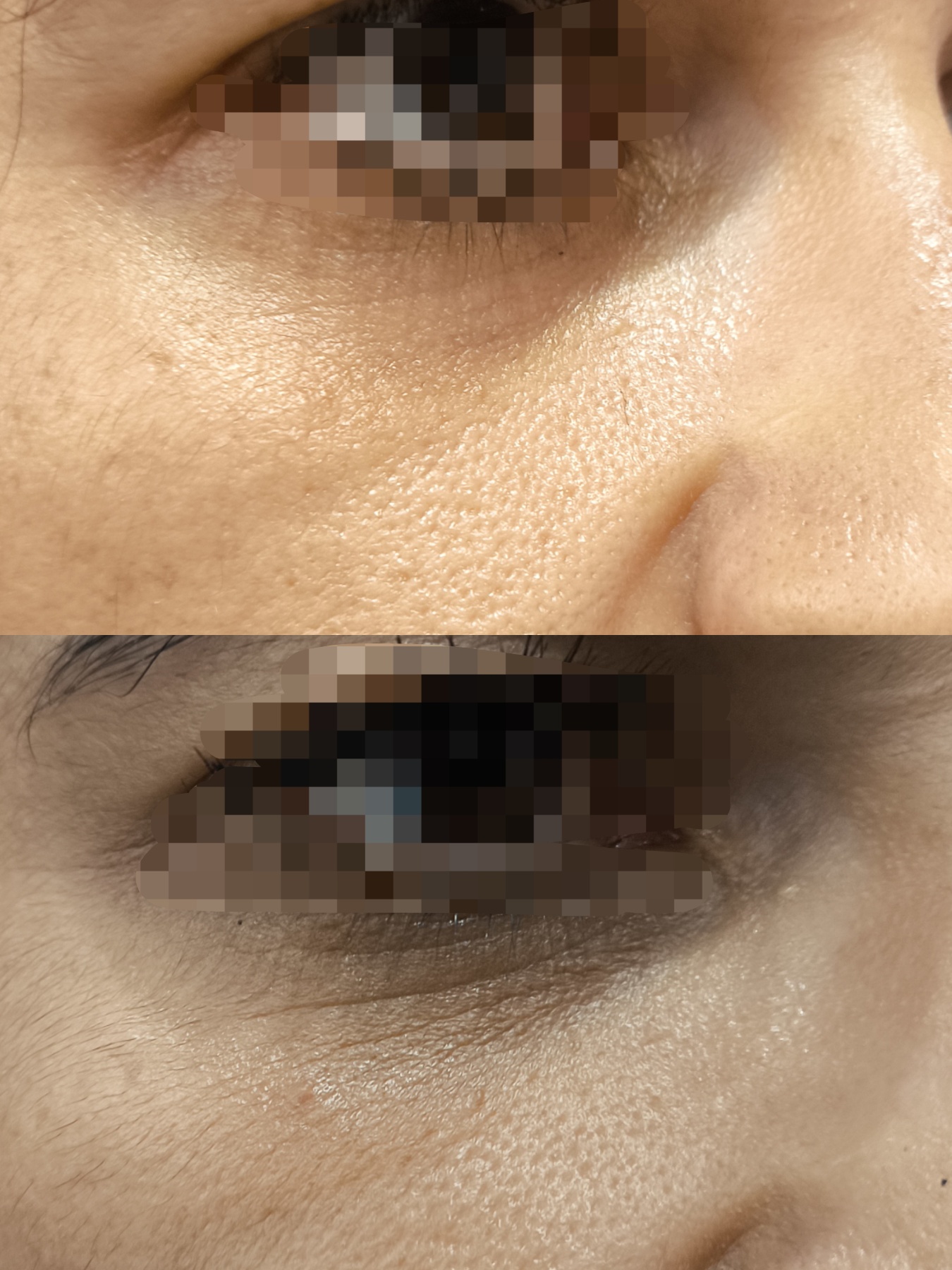 NeoE.V.O.Lift - Image 3